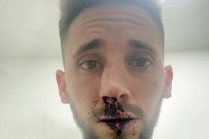 Un jugador de Platense fue golpeado durante los incidentes en la tribuna de Estudiantes (BA)-Chacarita