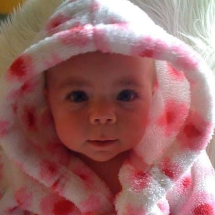 Inicialmente, Sophia no mostró signos de la afección, pero más tarde hubo algunos retrasos en su desarrollo.