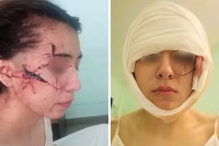 Intentaron degollarla: una adolescente fue desfigurada por cinco jóvenes cuando iba al kiosco