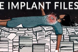 La historia mundial: los implantes médicos pueden dañar a los pacientes