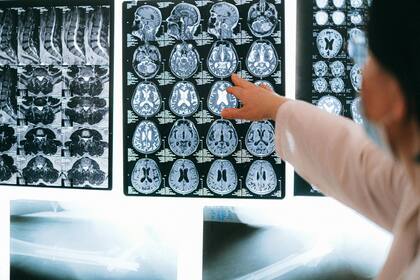 Investigadores de la Universidad Concordia en Canadá analizaron imágenes del cerebro para examinar las regiones relacionadas con el lenguaje y el envejecimiento