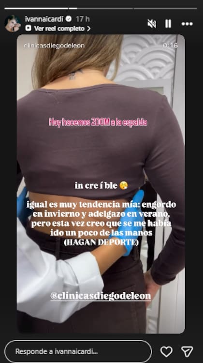 Ivana Icardi mostró cómo cambió su cuerpo tras el procedimiento (Foto: Instagram @ivannaicardi)