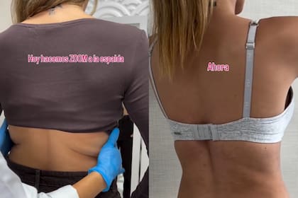Ivana Icardi mostró su antes y después tras realizarse una cirugía estética (Foto: Captura de video)