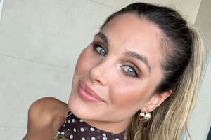 Ivana Icardi mostró su transformación física tras someterse a una cirugía estética