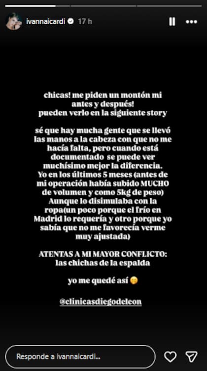 Ivana Icardi reveló que se realizó una cirugía estética (Foto: Instagram @ivannaicardi)