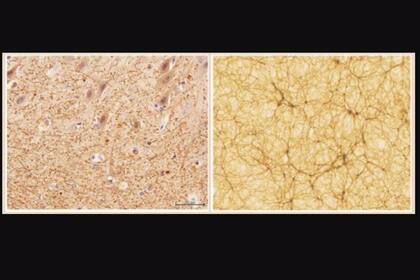 Izquierda: corte de cerebelo, con factor de aumento 40x, obtenido con microscopía electrónica. Derecha: sección de una simulación cosmológica, que se extiende 300 millones de años luz a cada lado