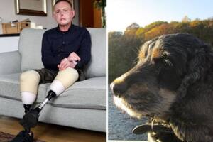 Jaco Nel jugaba con su perro, que le hizo una pequeña lastimadura en su mano, y dos semanas después luchaba por su vida en un hospital, víctima de una sepsis a causa de una bacteria presente en la saliva de su mascota