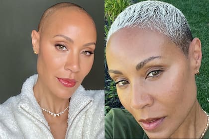 Jada Pinkett Smith comparte los resultados de su lucha contra la alopecia