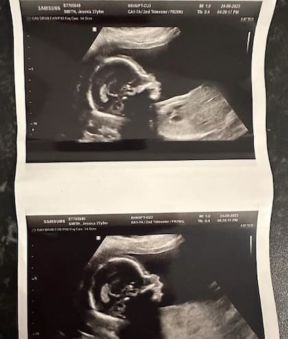 Jess Smith, la intérprete de Baby Sun, anunció que espera su primer hijo (Foto: Instagram/@j.smith_1995)