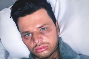 Jimmy Featherstone no entiende por qué lo golpearon