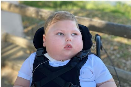 Joaquín, desde el día de su nacimiento, e el que sufrió hipoxia y daño neurológico, necesitó asistencias mecánicas para respirar y alimentarse. Hoy es "una estrellita en el cielo".