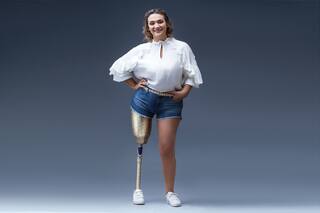 Perdió la pierna por un virus de hospital y es ejemplo de superación en redes