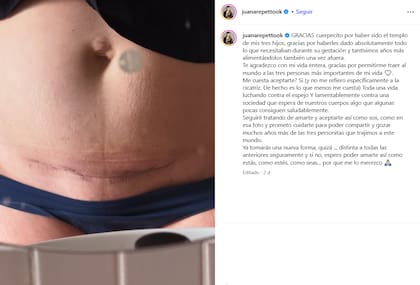 Juana Repetto y una profunda reflexión sobre su cicatriz tras ser madre (Foto: Instagram/@juanarepettook)