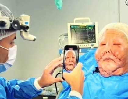 Juju inició un proceso de varias cirugías para recuperar su rostro (Foto: oliveirajuju35)