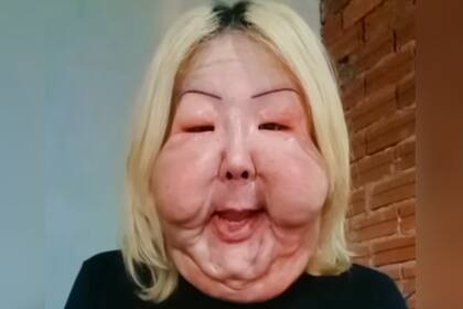 Juliana comenzó un procedimiento de extracción de tejidos (Foto: @oliveirajuju35)