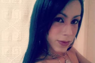 El drama que vive en su rostro una influencer brasileña tras someterse a un tratamiento estético clandestino