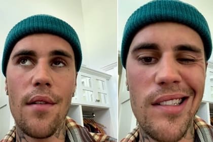 Justin Bieber contó que sufre una parálisis en la mitad de su rostro a través de un video de Instagram.