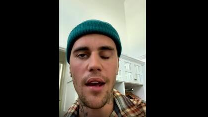 Justin Bieber se mostró al sufrir una parálisis facial