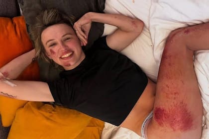 Kasia Niewiadoma subió las imágenes a las historias de su cuenta de Instagram