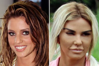 Katie Price luce irreconocible luego de la cantidad de cirugías a las que se sometió