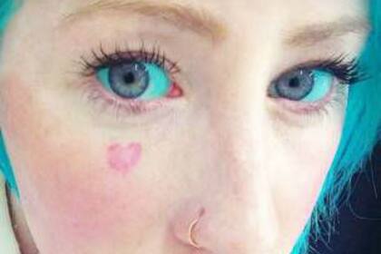 Kylie Garth ya había probado con decorarse el cuerpo con pendientes, ponerse las orejas puntiagudas y la lengua bífida, y quitarse pedazos de cartílago antes de probar el tatuaje del globo ocular