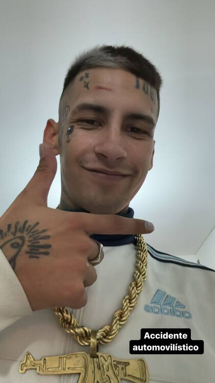 L-Gante sufrió un accidente arriba del auto y mostró la herida en su frente