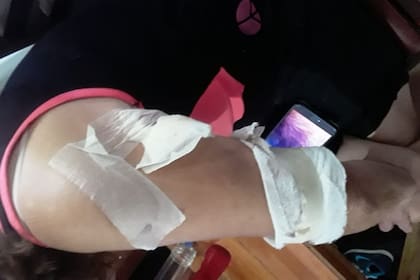 La abuela recibió múltiples heridas en el brazo por defender a su nieto