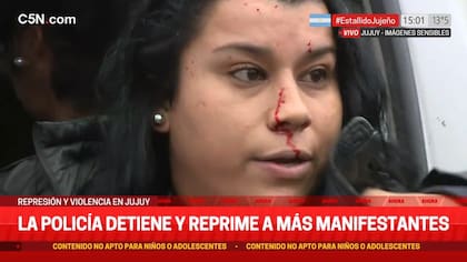 La activista que se golpeó adrede con la ventanilla de un patrullero fue mostrada como víctima de la represión