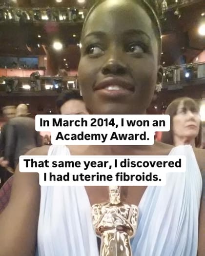 La actriz compartió una foto de ella en el 2014 para empezar a contar su experiencia (Foto: @lupitanyongo)