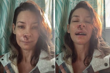 La actriz Evangeline Lily reveló con un video que posteó en Instagram que tiene daño cerebral como consecuencia de un accidente que sufrió en Hawái