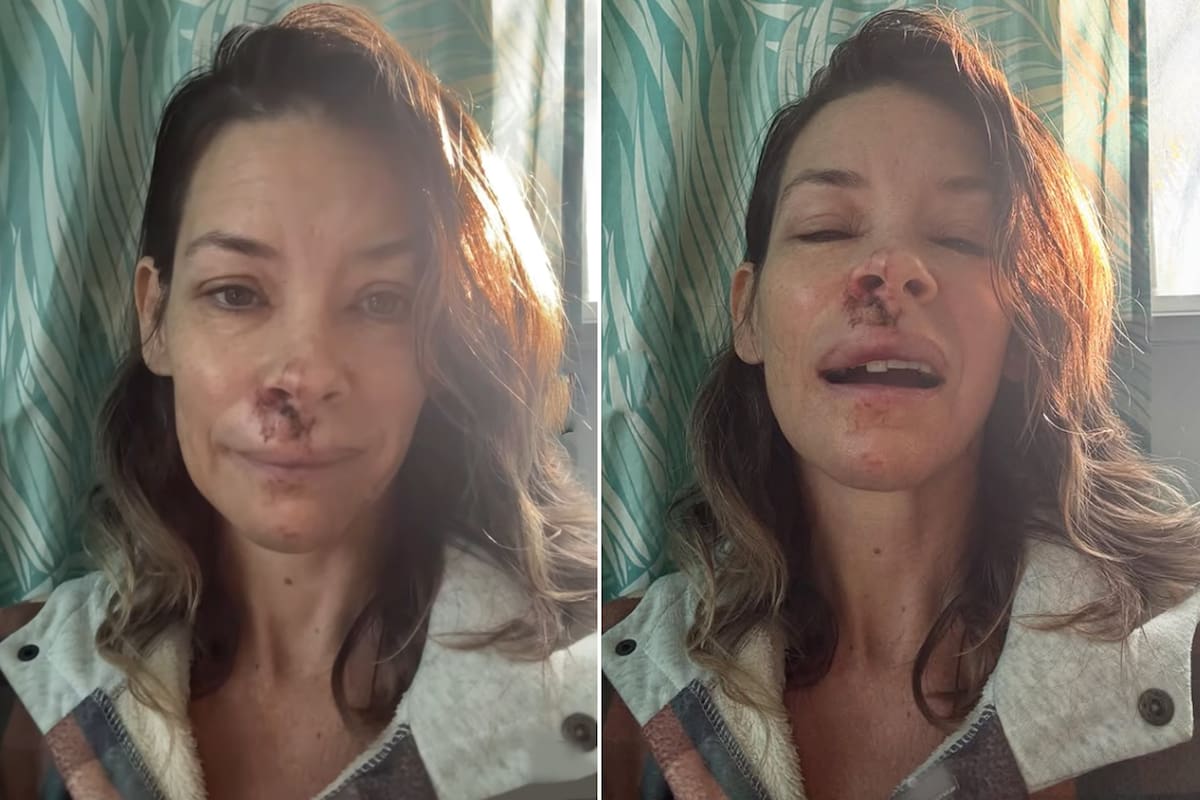 A atriz desaparecida Evangeline Lilly revelou que sofreu danos cerebrais após um acidente no Havaí A atriz desaparecida Evangeline Lilly revelou que sofreu danos cerebrais após um acidente no Havaí