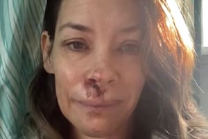 Evangeline Lilly, actriz de Lost, reveló que tiene daño cerebral tras un accidente en Hawái