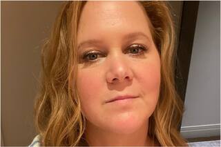 Amy Schumer se hartó de los comentarios sobre su cuerpo y su rostro: “Tengo problemas de salud”