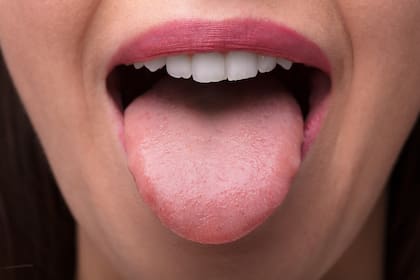 “La acumulación de residuo en la lengua huele mal porque las colonias bacterianas pueden instalarse y vivir allí”, señala Ananda P. Dasanayake, profesora de epidemiología en la Facultad de Odontología de la Universidad de Nueva York