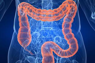 Un doctor de Harvard revela el alimento que se debe consumir para prevenir el cáncer de colon