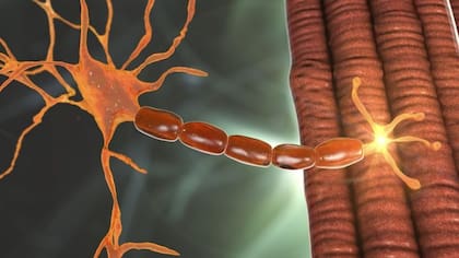 La AME es causada por una serie de anomalías que afectan a las neuronas involucradas