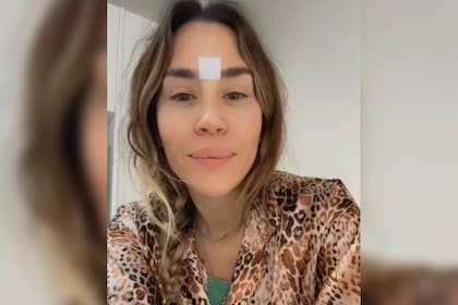 La artista mostró cómo desaparecieron sus arrugas del entrecejo (Captura video)