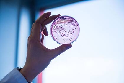 La bacteria E. Coli es resistente a múltiples fármacos 