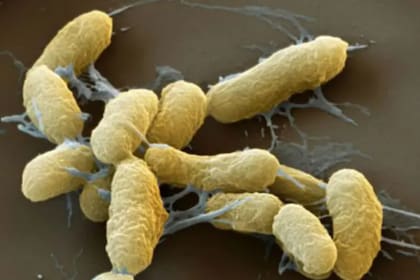 La bacteria yersinia pestis habita en pequeños roedores y pasan al humano a través de las pulgas que pican a estos animales; si no se trata a la persona infectada, puede morir en poco tiempo