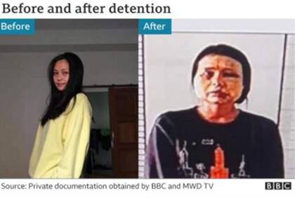 La BBC le preguntó a Zaw Min Tun por qué los militares no ocultaron las heridas.