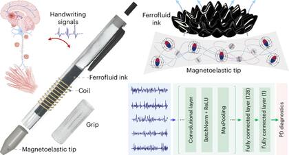 La birome tiene una tinta con ferrofluido; al escribir en papel el trazo que deja ese ferrofluido es registrado por un sensor y permite detectar temblores muy leves relacionados con la etapa temprana de Parkinson