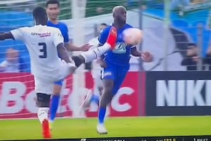 La brutal patada en la Copa de Francia que dejó a un jugador en el hospital