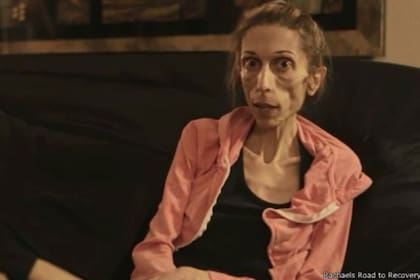 La campaña "Rachael''s Road to Recovery" ha conseguido recaudar más de los US$100.000 necesarios para su tratamiento