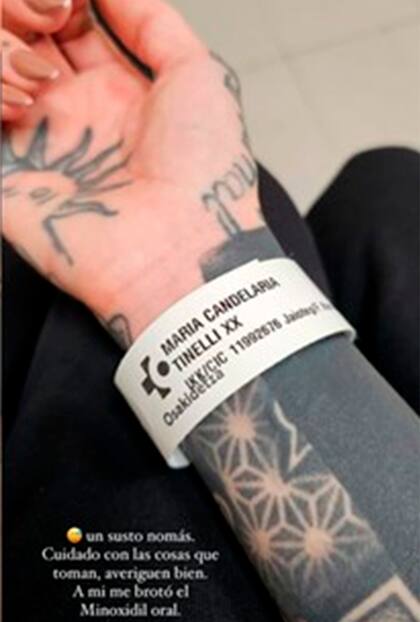 La cantante e influencer debió ser atendida de urgencia