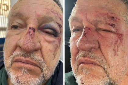 La cara del hombre que fue agredido por un transeúnte luego de tropezarse en plena calle