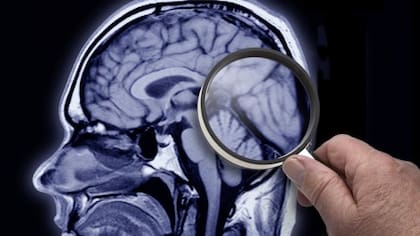 La causa de nuestros pensamientos intrusivos es muchas veces simplemente el burbujeo constante de ideas y recuerdos en nuestros atareados cerebros