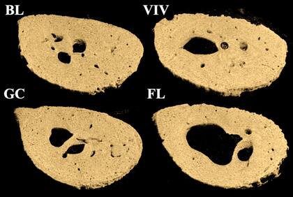 La cavidad medular del cuello femoral se agranda durante los vuelos espaciales, pero no cambia significativamente con la edad y las condiciones del hábitat, según los investigadores