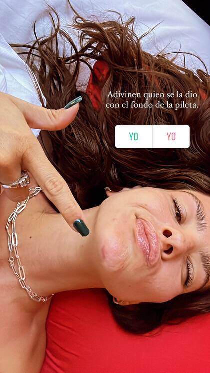 La China Suárez mostró el golpe que se dio en la pera