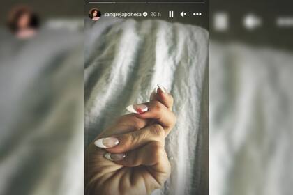 La China Suárez mostró la lastimadura que sufrió en su uña (Foto Instagram @sangrejaponesa)