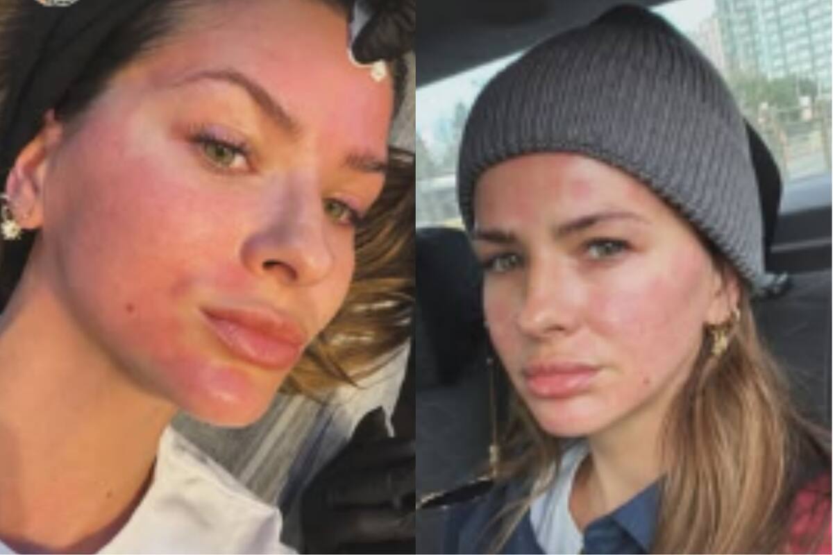 Chyna Suarez passou por uma cirurgia estética na Turquia e surpreendeu a todos com sua aparência facial Chyna Suarez passou por uma cirurgia estética na Turquia e surpreendeu a todos com sua aparência facial